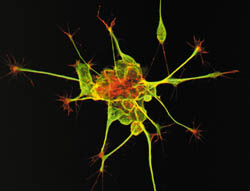 [1] «Комок нервов». Kate Nobes and Mark Shipman/The Wellcome Trust. Confocal image.