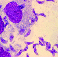 ������ ���������� ������ � Toxoplasma gondii ����� ������ �������