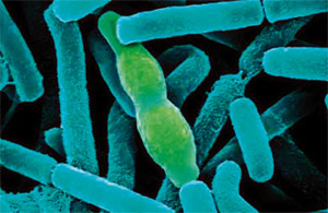 �������� Bacillus Anthracis (��������� � 2200 ���).